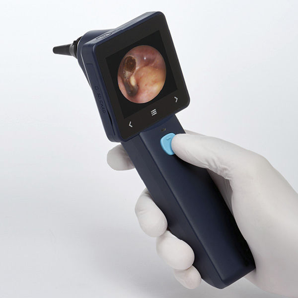 Otoscope vidéo